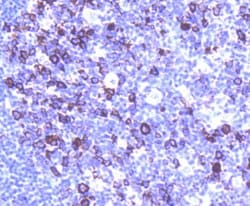 Invitrogen Cyclin B1 Recombinant Rabbit Monoclonal Antibody (SU33-03) 100 &mu;L | Buy Online | Invitrogen&trade; | Fisher Scientific