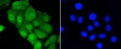 Invitrogen YAP1 Recombinant Rabbit Monoclonal Antibody (SU33-06) 100 &mu;L;
