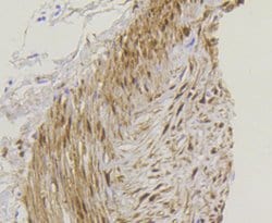 Invitrogen YAP1 Recombinant Rabbit Monoclonal Antibody (SU33-06) 100 &mu;L;