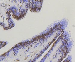 Invitrogen YAP1 Recombinant Rabbit Monoclonal Antibody (SU33-06) 100 &mu;L;