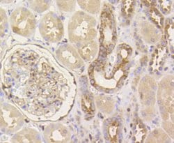 Invitrogen YAP1 Recombinant Rabbit Monoclonal Antibody (SU33-06) 100 &mu;L;