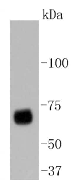 Invitrogen YAP1 Recombinant Rabbit Monoclonal Antibody (SU33-06) 100 &mu;L;