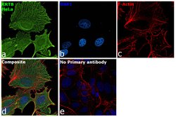 Invitrogen Cytokeratin 8 Recombinant Rabbit Monoclonal Antibody (SU0338)
