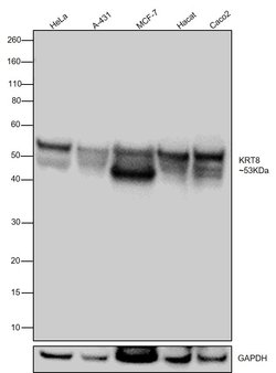 Invitrogen Cytokeratin 8 Recombinant Rabbit Monoclonal Antibody (SU0338)