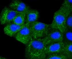 Cytokeratin 8 Recombinant Rabbit Monoclonal Antibody (SU0338), Invitrogen&trade; 100 &mu;L; Unconjugated 