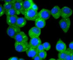 Invitrogen TrkA Recombinant Rabbit Monoclonal Antibody (SU0354) 100 &mu;L;