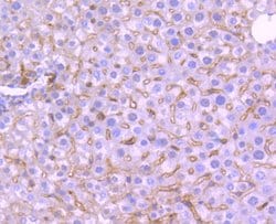 Invitrogen TrkA Recombinant Rabbit Monoclonal Antibody (SU0354) 100 &mu;L;