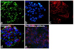 Invitrogen Cathepsin D Recombinant Rabbit Monoclonal Antibody (SU0360) 100 &mu;L | Buy Online | Invitrogen&trade; | Fisher Scientific