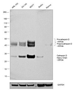 Invitrogen Cathepsin D Recombinant Rabbit Monoclonal Antibody (SU0360) 100 &mu;L | Buy Online | Invitrogen&trade; | Fisher Scientific