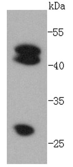 Invitrogen Cathepsin D Recombinant Rabbit Monoclonal Antibody (SU0360) 100 &mu;L | Buy Online | Invitrogen&trade; | Fisher Scientific