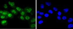 Invitrogen Phospho-RSK1 (Thr359, Ser363) Recombinant Rabbit Monoclonal