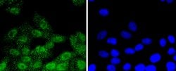 Invitrogen Phospho-RSK1 (Thr359, Ser363) Recombinant Rabbit Monoclonal