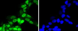 Invitrogen Phospho-RSK1 (Thr359, Ser363) Recombinant Rabbit Monoclonal