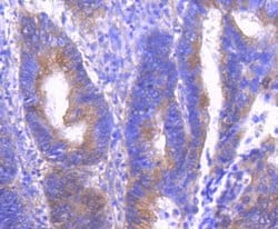 Invitrogen Phospho-PAK1/2/3 (Ser144, Ser141, Ser139) Recombinant Rabbit