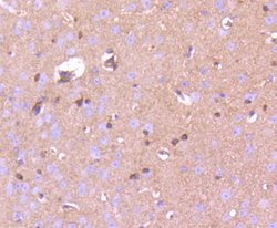 Invitrogen Phospho-PAK1/2/3 (Ser144, Ser141, Ser139) Recombinant Rabbit