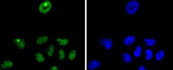 Invitrogen p27 Kip1 Recombinant Rabbit Monoclonal Antibody (SU37-04) 100