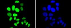 Invitrogen p27 Kip1 Recombinant Rabbit Monoclonal Antibody (SU37-04) 100