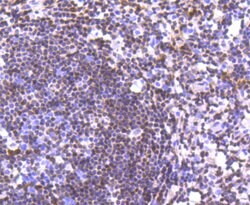 Invitrogen p27 Kip1 Recombinant Rabbit Monoclonal Antibody (SU37-04) 100