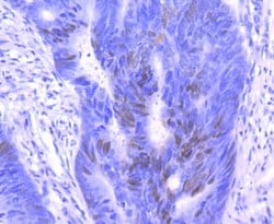 Invitrogen p27 Kip1 Recombinant Rabbit Monoclonal Antibody (SU37-04) 100