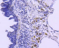 Invitrogen p27 Kip1 Recombinant Rabbit Monoclonal Antibody (SU37-04) 100