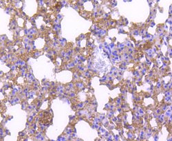 Invitrogen p27 Kip1 Recombinant Rabbit Monoclonal Antibody (SU37-04) 100