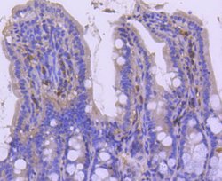 Invitrogen p27 Kip1 Recombinant Rabbit Monoclonal Antibody (SU37-04) 100