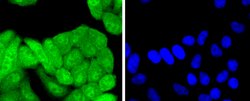 Invitrogen p16INK4a Recombinant Rabbit Monoclonal Antibody (SU0702) 100