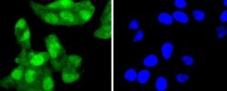 Invitrogen p16INK4a Recombinant Rabbit Monoclonal Antibody (SU0702) 100