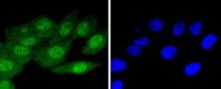 Invitrogen p16INK4a Recombinant Rabbit Monoclonal Antibody (SU0702) 100