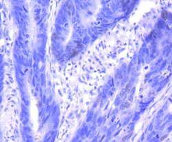 Invitrogen p16INK4a Recombinant Rabbit Monoclonal Antibody (SU0702) 100