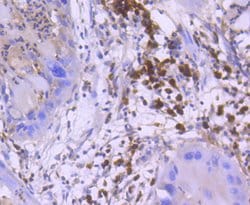 Invitrogen Active/Pro-Caspase 3 Recombinant Rabbit Monoclonal Antibody