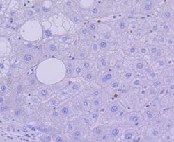 Invitrogen Active/Pro-Caspase 3 Recombinant Rabbit Monoclonal Antibody