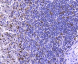Invitrogen Active/Pro-Caspase 3 Recombinant Rabbit Monoclonal Antibody