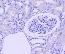 Invitrogen Active/Pro-Caspase 3 Recombinant Rabbit Monoclonal Antibody