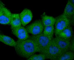 Invitrogen M-CSF Recombinant Rabbit Monoclonal Antibody (SU0413) 100 &mu;L;