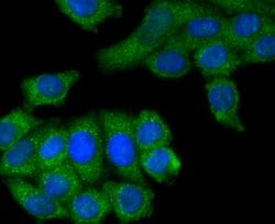 Invitrogen M-CSF Recombinant Rabbit Monoclonal Antibody (SU0413) 100 &mu;L;