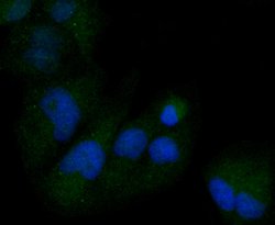 Invitrogen M-CSF Recombinant Rabbit Monoclonal Antibody (SU0413) 100 &mu;L;