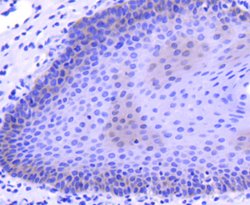 Invitrogen M-CSF Recombinant Rabbit Monoclonal Antibody (SU0413) 100 &mu;L;