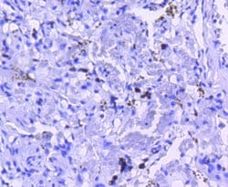 Invitrogen M-CSF Recombinant Rabbit Monoclonal Antibody (SU0413) 100 &mu;L;
