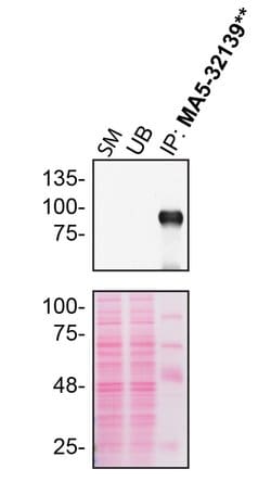 Invitrogen M-CSF Recombinant Rabbit Monoclonal Antibody (SU0413) 100 &mu;L;