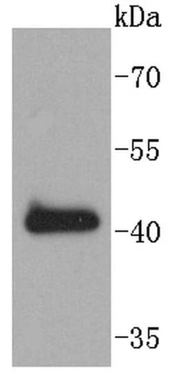 Invitrogen SOX18 Recombinant Rabbit Monoclonal Antibody (ST43-02) 100 &mu;L | Buy Online | Invitrogen&trade; | Fisher Scientific
