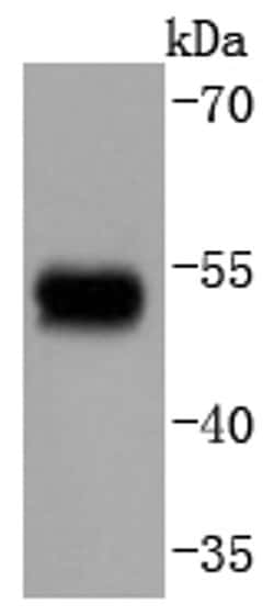 Invitrogen Phospho-GATA3 (Ser308) Recombinant Rabbit Monoclonal Antibody