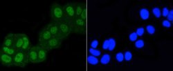 Invitrogen ASH2L Recombinant Rabbit Monoclonal Antibody (ST47-01) 100 &mu;L;