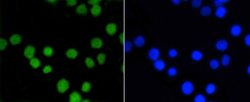 Invitrogen ASH2L Recombinant Rabbit Monoclonal Antibody (ST47-01) 100 &mu;L;
