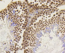 Invitrogen ASH2L Recombinant Rabbit Monoclonal Antibody (ST47-01) 100 &mu;L;