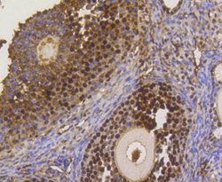Invitrogen ASH2L Recombinant Rabbit Monoclonal Antibody (ST47-01) 100 &mu;L;