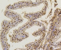 Invitrogen ASH2L Recombinant Rabbit Monoclonal Antibody (ST47-01) 100 &mu;L;