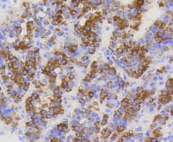 Invitrogen TOMM20 Recombinant Rabbit Monoclonal Antibody (ST04-72) 100