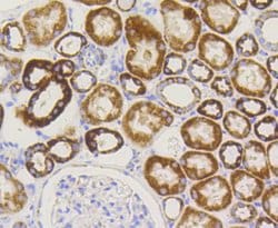 Invitrogen TOMM20 Recombinant Rabbit Monoclonal Antibody (ST04-72) 100