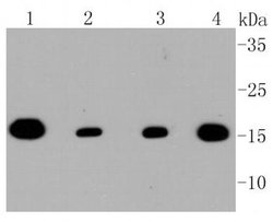 Invitrogen TOMM20 Recombinant Rabbit Monoclonal Antibody (ST04-72) 100